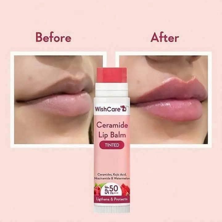 WishCare Ceramide Lip Balm – SPF 50+ - Image 4
