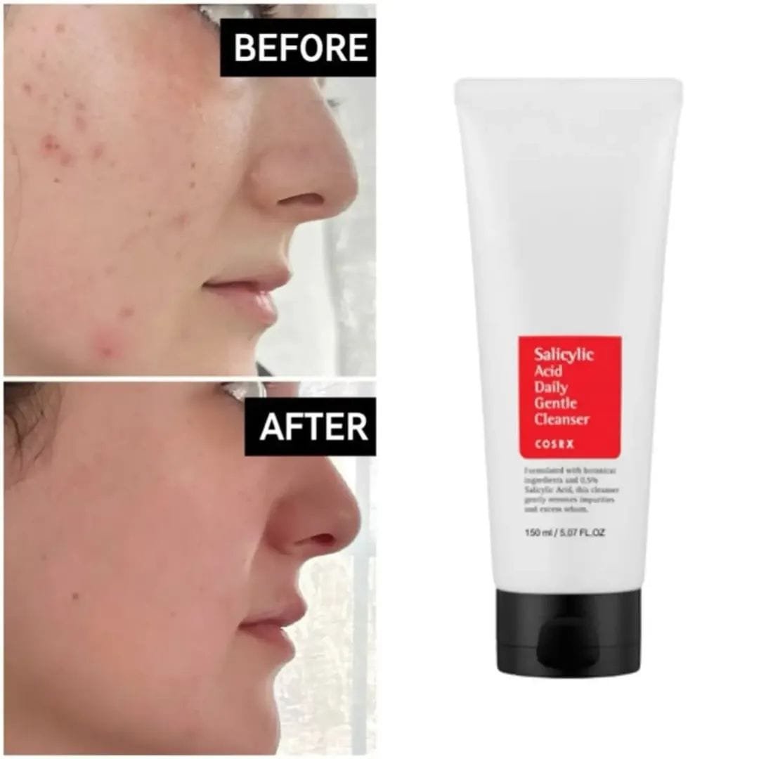 COSRX Salicylic Acid Daily Gentle Cleanser — 150ml - Image 3